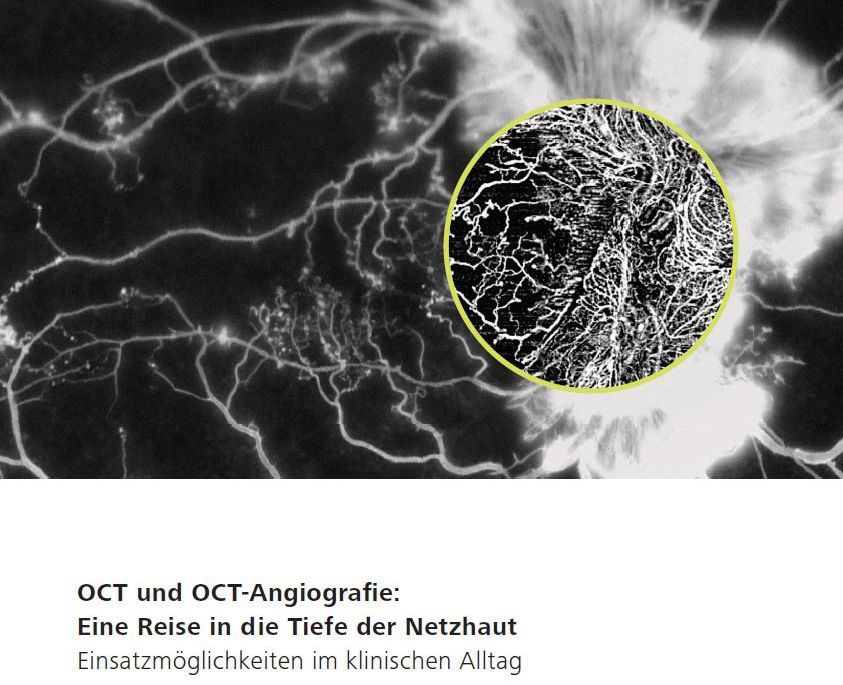 Untersuchung bei Augenarzt Dr. Klaus Ofner